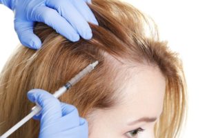 Eigenbluttherapie Haare