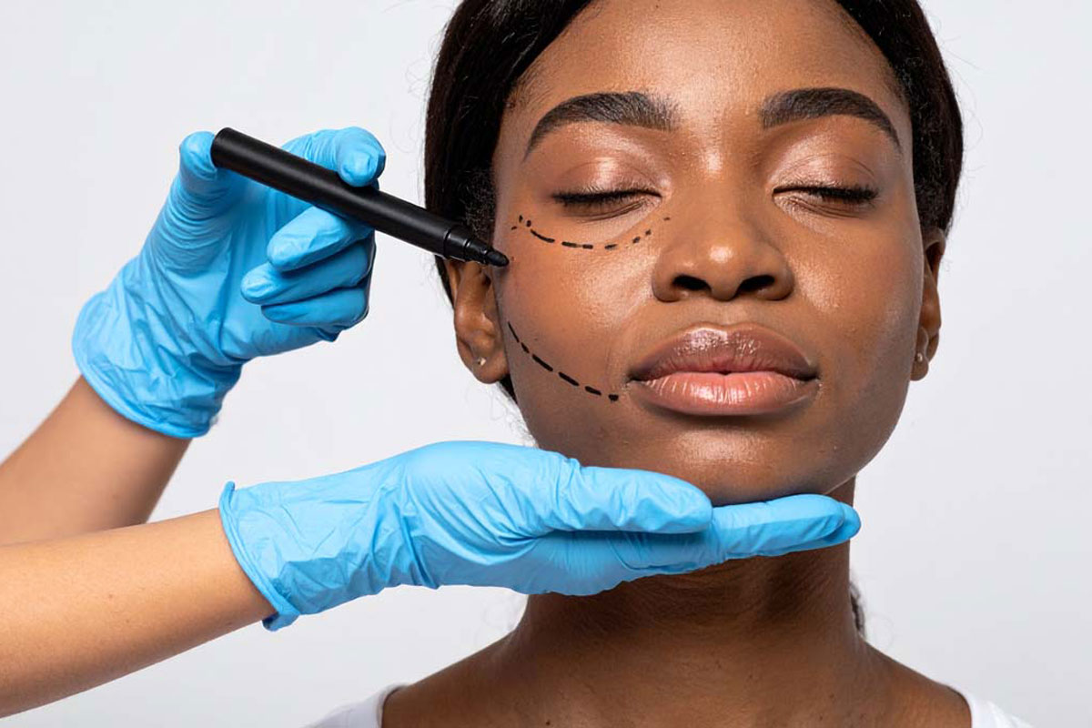 facelifting-dortmund Facelifting