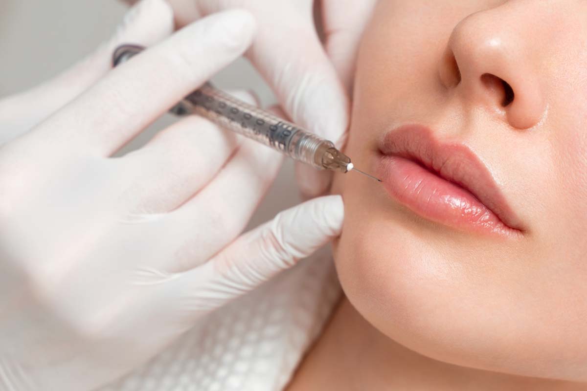 Lippenkorrekturen